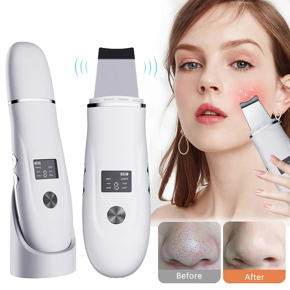 Ultrasonic Deep Face Cleaning Spatula